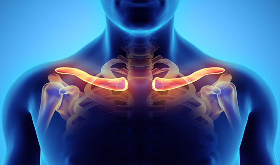 Collarbone Pain Left Side Causes, Treatments Prevention cstims